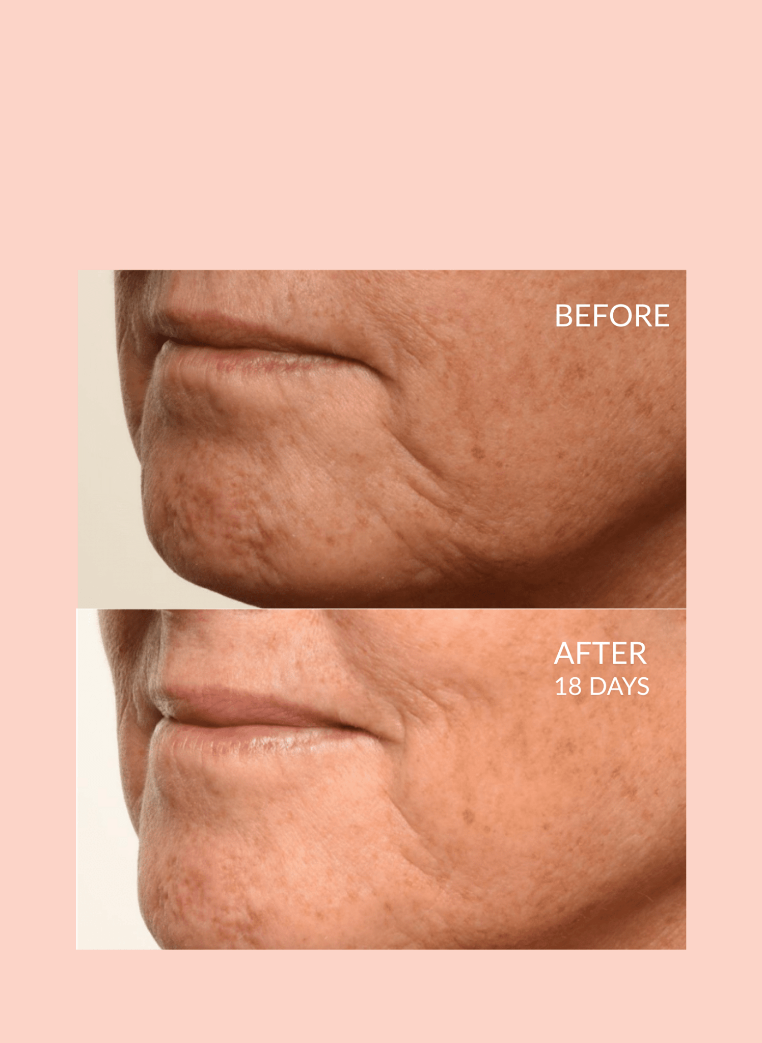 Theorem Serum Boost – Skincare Nourishing & Repair Serum