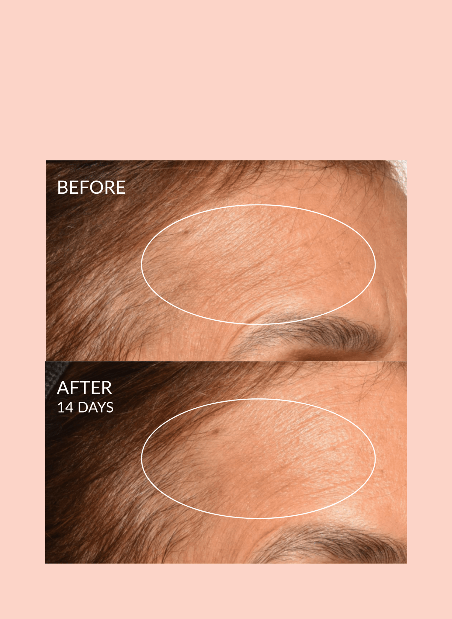 Theorem Serum Boost – Skincare Nourishing & Repair Serum