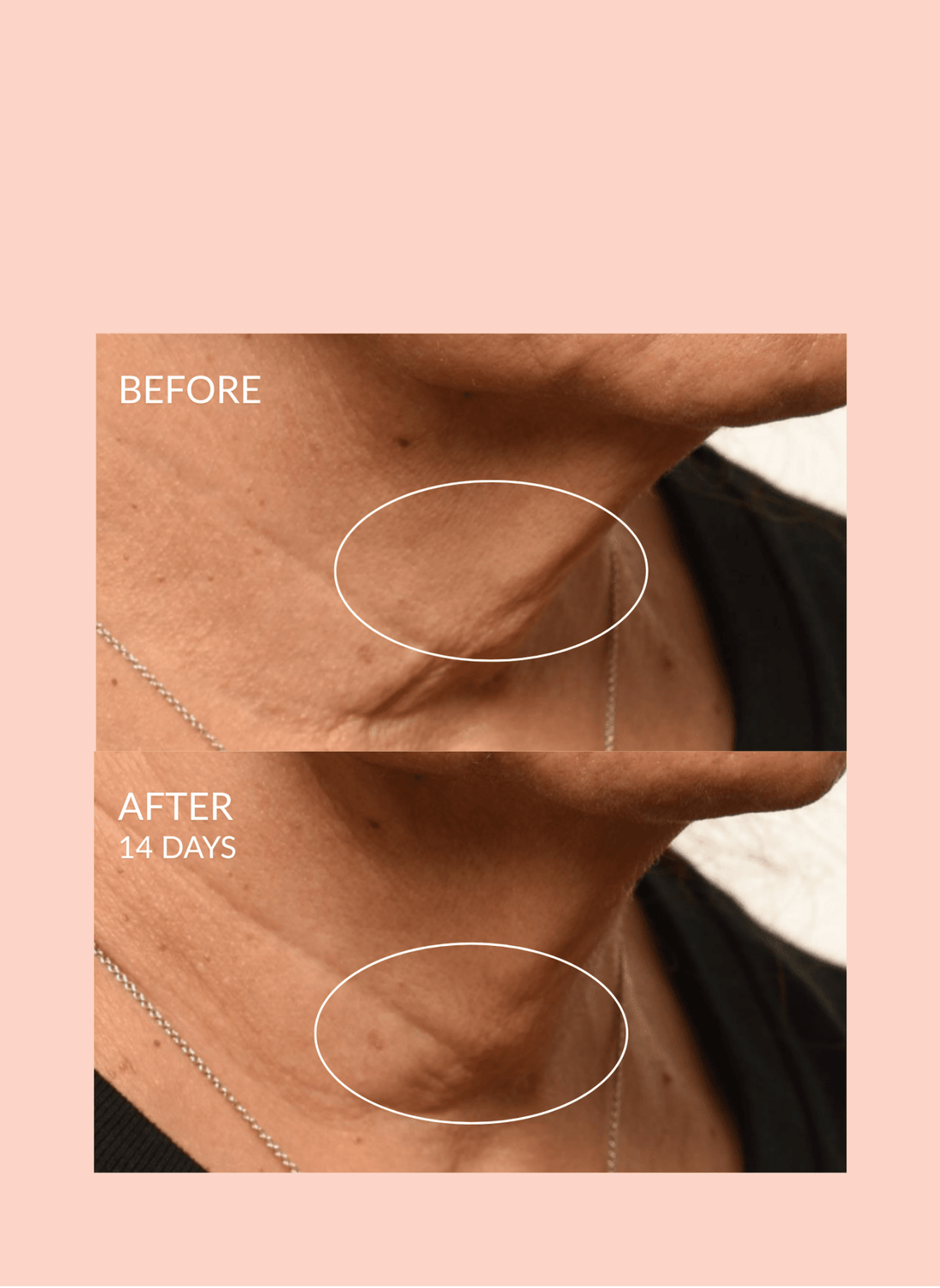 Theorem Serum Boost – Skincare Nourishing & Repair Serum